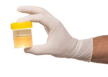 Un barattolo per l'esame delle urine